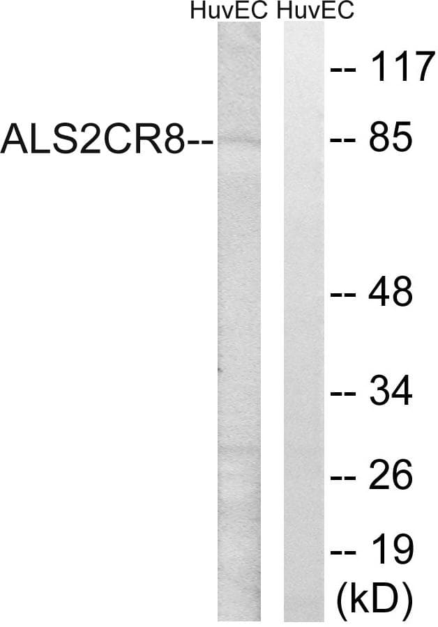 Polyclonal Rabbit anti-Human CARF / ALS2CR8 Antibody (IHC, WB)