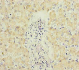 Polyclonal Rabbit anti-Human SCEH / ECHS1 Antibody (IHC, WB)
