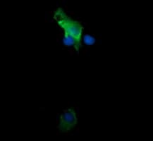 TRIM38 Antibody (clone OTI2G9)