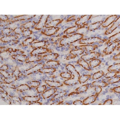 Polyclonal Rabbit anti-Human BCL2L1 / BCL-XL Antibody (phospho-Thr47, IHC, IF, WB)