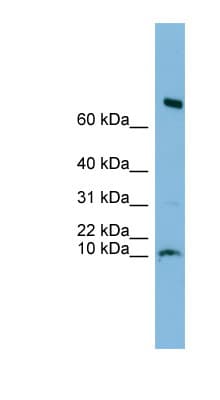 Polyclonal Rabbit anti-Human C1orf122 Antibody (N-Terminus, WB)
