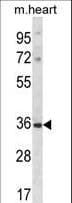 DLX5 Antibody (aa100-128)