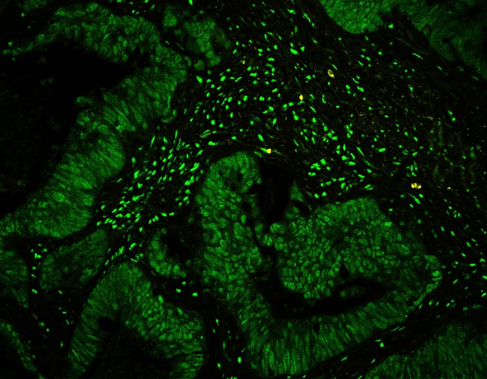 Polyclonal Rabbit anti-Human CTBP1 / CTBP Antibody (aa409-440, IHC, WB)