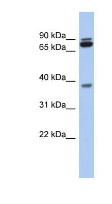 Polyclonal Rabbit anti-Human PRR19 Antibody (aa107-156, WB)