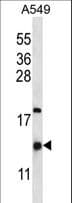 HIGD2A Antibody (aa15-44)