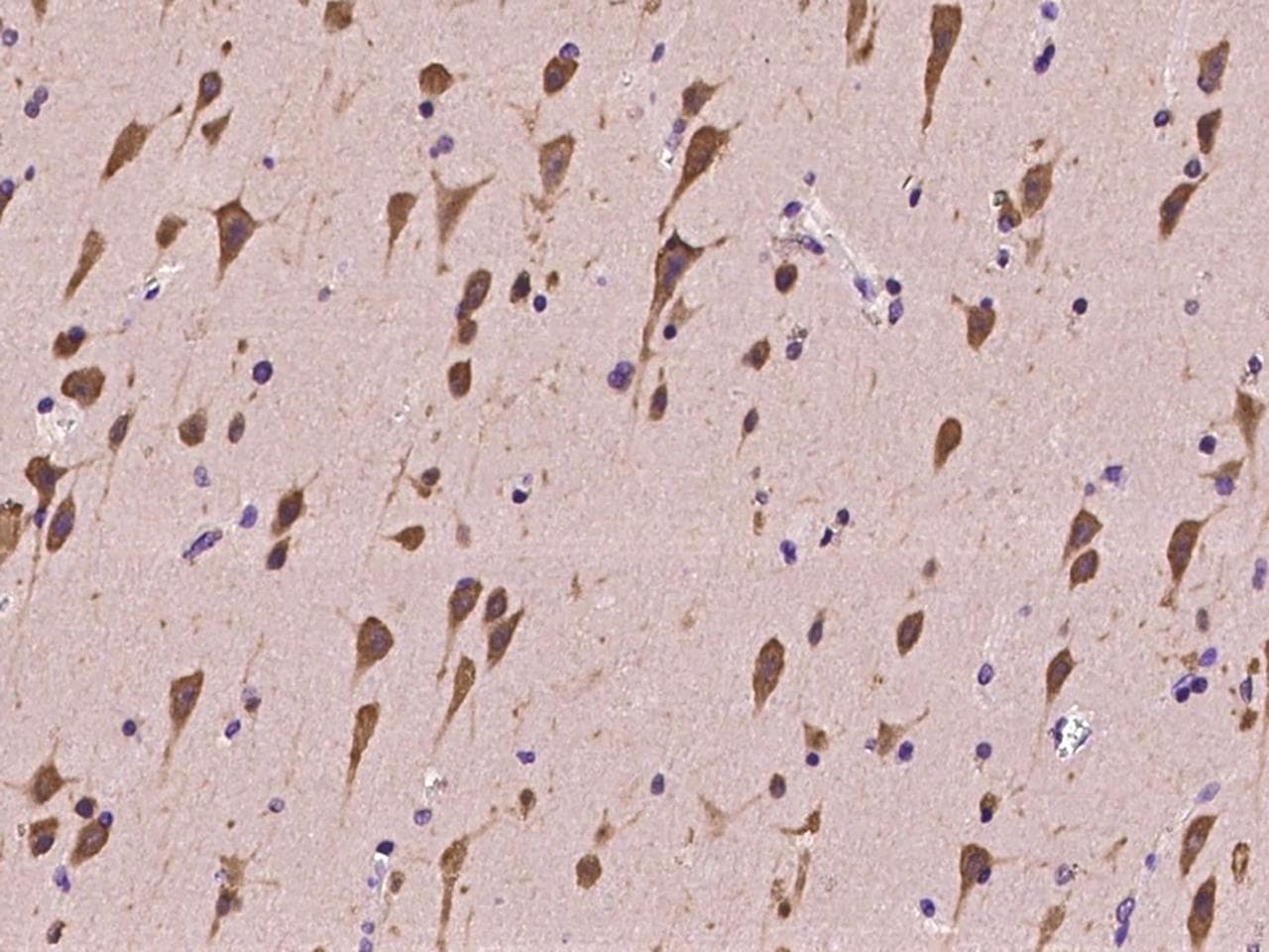 SRPK2 Antibody