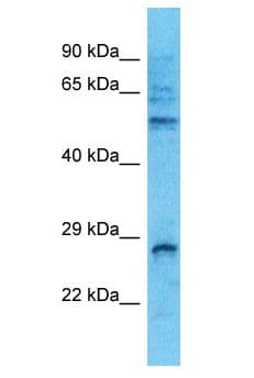 RAB14 Antibody (aa121-170)