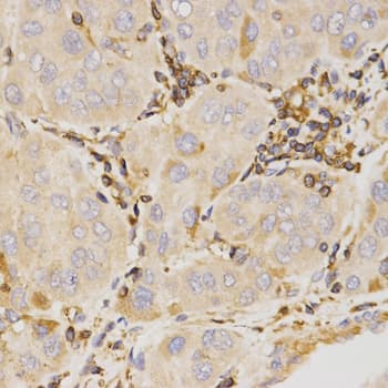 IHC-plus™ Polyclonal Rabbit anti-Human KLK5 / Kallikrein 5 Antibody (IHC, WB)