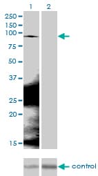 CTNNB1 / Beta Catenin Antibody (clone 1C9)