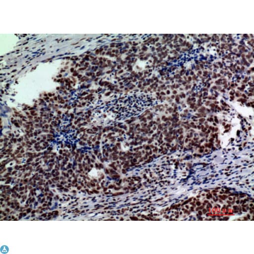Polyclonal Rabbit anti-Human GLB1 / Beta-Galactosidase Antibody (IHC, WB)