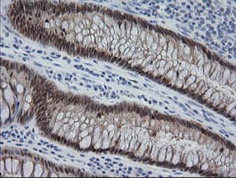 CMPK / CMPK1 Antibody (clone OTI1A9)