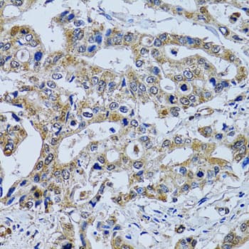 Polyclonal Rabbit anti-Human TPPP3 Antibody (IHC, WB)