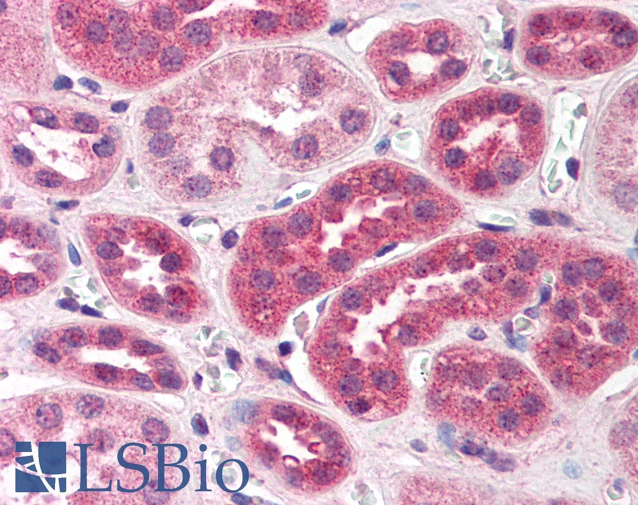 IHC-plus™ Polyclonal Rabbit anti-Human TANK Antibody (IHC, IF, WB)