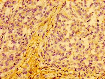 Polyclonal Rabbit anti-Human COX15 Antibody (IHC, WB)