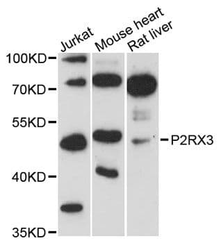 P2RX3 / P2X3 Antibody