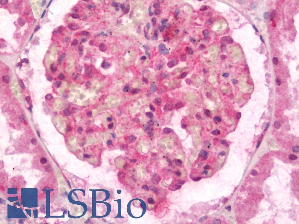 IHC-plus™ Polyclonal Rabbit anti-Human NPHS1 / Nephrin Antibody (IHC, IF, WB)