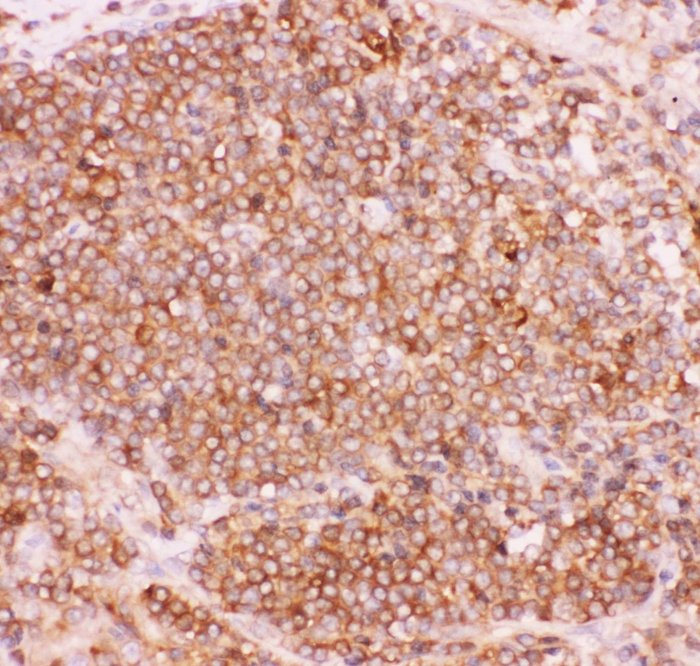 NFKB2 Antibody (aa1-340)