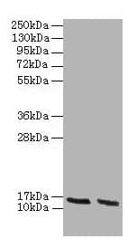 IHC-plus™ HBA1+2 / Hemoglobin Alpha Antibody