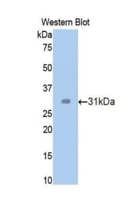 NRG1 / Heregulin / Neuregulin Antibody (aa13-259)
