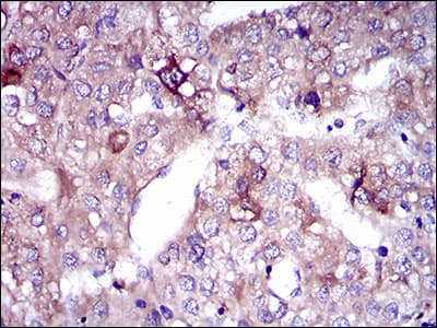 Monoclonal Mouse anti-Human SLC27A5 / BACS Antibody (clone 4B11C10, aa508-570, IHC, WB)