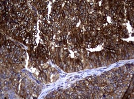 Monoclonal Mouse anti-Human TS / Thymidylate Synthase Antibody (clone 10F12, Carrier-free, IHC, WB)
