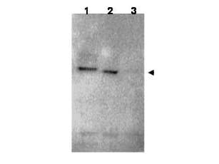 IHC-plus™ Polyclonal Rabbit anti-Human RNF25 Antibody (IHC, WB)