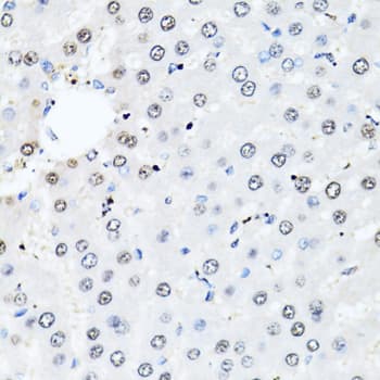 Polyclonal Rabbit anti-Human HIST2H2BE Antibody (IHC, WB)
