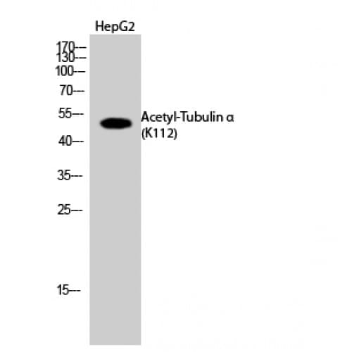 Alpha Tubulin Antibody (acetylation site of K112.)