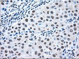 MAP2K2 / MKK2 / MEK2 Antibody (clone OTI8G6)