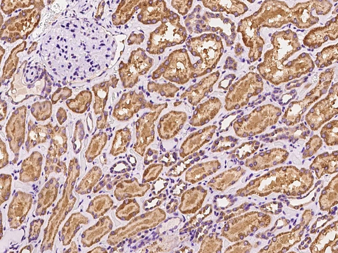 AIFM1 / AIF / PDCD8 Antibody