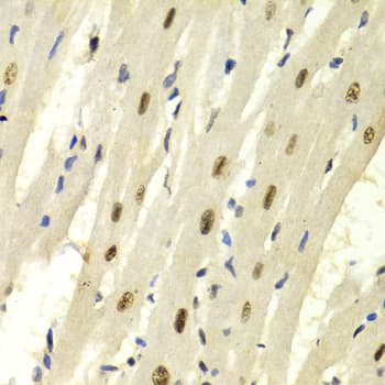 QIP1 / KPNA4 Antibody