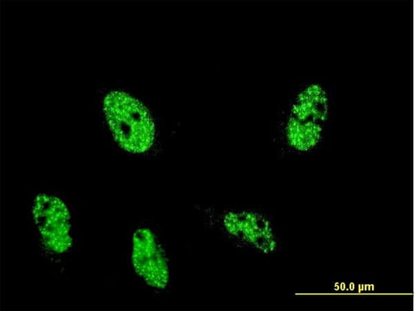 ARID4A Antibody (clone 2G8)