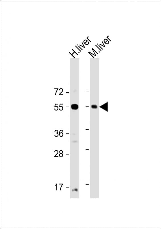 UGT1A9 Antibody (N-Terminus)