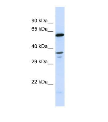 Polyclonal Rabbit anti-Human GALNT10 Antibody (aa445-494, WB)
