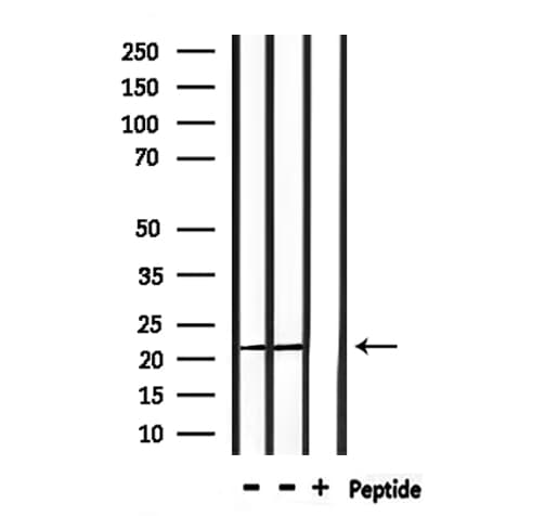 PRDX2 / Peroxiredoxin 2 Antibody
