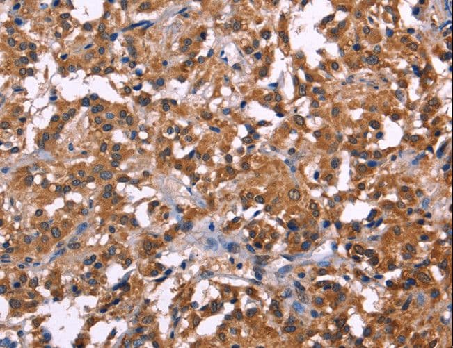 NOS2 / iNOS Antibody