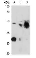 KCNJ11 / Kir6.2 Antibody