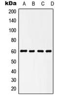 PathPlus™ HSPD1 / HSP60 Antibody (C-Terminus)