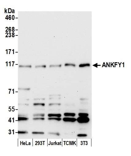 Polyclonal Rabbit anti-Human ANKFY1 Antibody (aa1-50, WB)