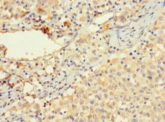 Polyclonal Rabbit anti-Human VTN / Vitronectin Antibody (IHC, IF, WB)