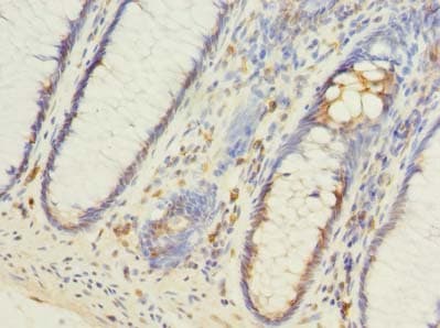 FILIP1L Antibody