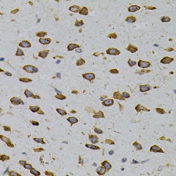 CAPRIN1 Antibody (aa1-300)