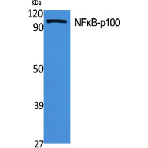 Polyclonal Rabbit anti-Human NFKB2 Antibody (810-890 aa, IHC, IF, WB)