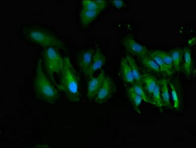 Polyclonal Rabbit anti-Human UGT1A9 Antibody (IHC, IF)