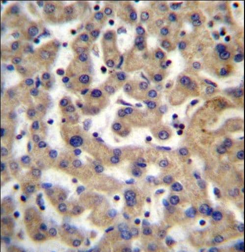 Polyclonal Rabbit anti-Human PDP1 Antibody (aa308-336, IHC, WB)