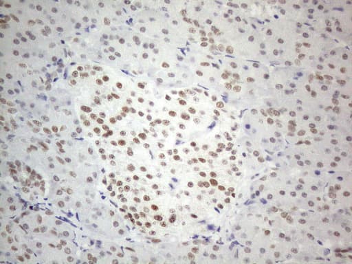 Monoclonal Mouse anti-Human CWC27 Antibody (clone OTI4C8, aa145-472, IHC, WB)