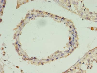 ZNF397 Antibody