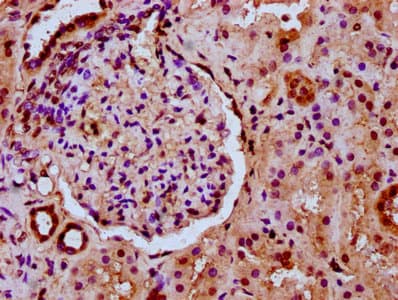 HIST1H2BN Antibody