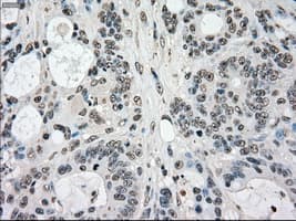 Monoclonal Mouse anti-Human STK3 Antibody (clone OTI2D4, IHC, WB)
