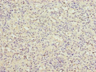 Polyclonal Rabbit anti-Human LRRC3B Antibody (IHC)